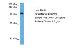 SRGAP3 Rabbit anti-Human, Polyclonal, Novus Biologicals 0.1ml; Unconjugated:Antibodies,